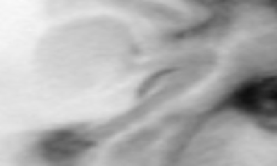 \begin{figure}\epsfig{file=synth-341.ps}\end{figure}