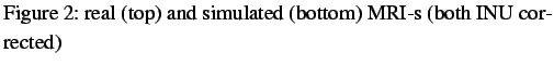 $\textstyle \parbox{0.9\linewidth}{
\figurenum real (top) and simulated (bottom) MRI-s (both INU corrected)}$