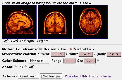 \psfig{figure=figs/ns_bw_view.ps,width=0.75\linewidth}