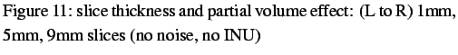 $\textstyle \parbox{0.9\linewidth}{
\figurenum slice thickness and partial volume effect: (L to R) 1mm,
5mm, 9mm slices (no noise, no INU)}$