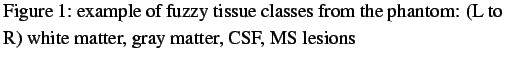 $\textstyle \parbox{0.9\linewidth}{ \figurenum example of fuzzy tissue classes
from the phantom: (L to R) white matter, gray matter, CSF, MS lesions}$