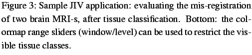 $\textstyle \parbox{0.9\linewidth}{
\figurenum
Sample JIV application: evalua...
...
sliders (window/level) can be used to restrict the visible tissue
classes.
}$