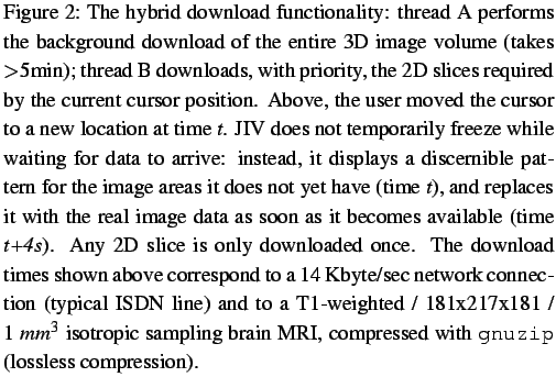 $\textstyle \parbox{0.9\linewidth}{
\figurenum
The hybrid download functional...
... sampling brain MRI, compressed with \texttt{gnuzip}
(lossless compression).
}$