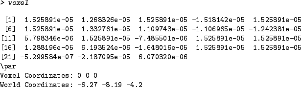 \begin{Schunk}
\begin{Sinput}
> voxel
\end{Sinput}\begin{Soutput}[1]1.525891e-05...
...ordinates: 0 0 0
World Coordinates: -6.27 -8.19 -4.2
\end{Soutput}\end{Schunk}