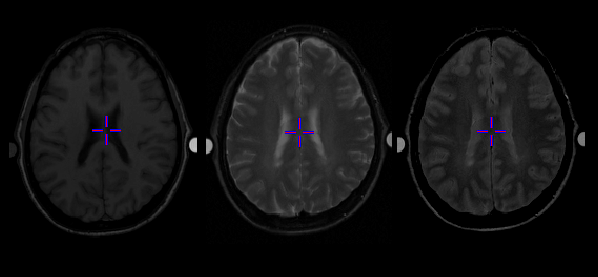 figure241
