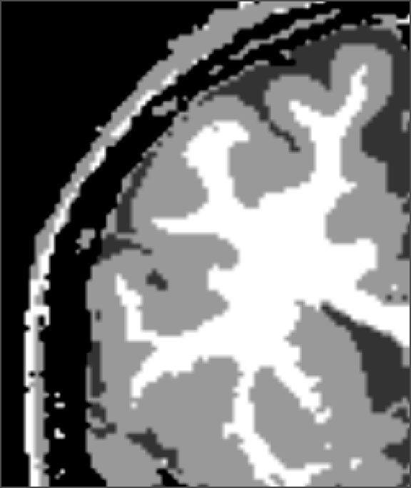 MRI image