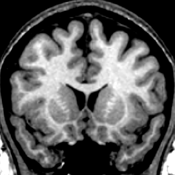MRI image