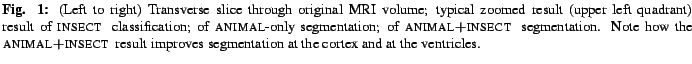 $\textstyle \parbox{6in}{
\small{{\bf Fig. 1:} (Left to right) Transverse slice...
...\end{sc}~
result improves segmentation at the cortex and at the ventricles.} }$