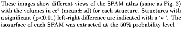 % latex2html id marker 420
$\textstyle \parbox{5in}{
These images show differen...
...$ '. The isosurface of each SPAM was extracted at
the 50\% probability level.}$