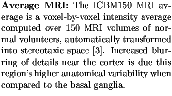 $\textstyle \parbox{3in}{ {\bf Average MRI:} The ICBM150 MRI average is a voxel-...
...is region's higher
anatomical variability when compared to the basal ganglia.}$