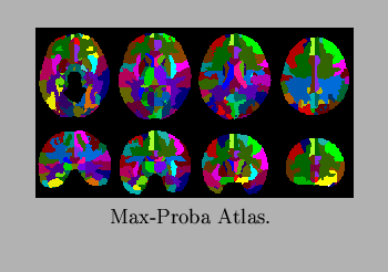 $\textstyle \parbox{3in}{
\begin{center}
\leavevmode
\centerline{\epsfxsize=2.5i...
...fbox{spam150.eps}}
\vspace{0.5em}
\centerline{Max-Proba Atlas.
}
\end{center}}$