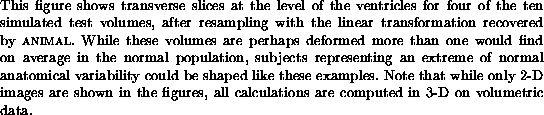 \begin{figure}\begin{center}
\centerline{
\epsfxsize=3cm \epsfbox{./paper-92-fi...
...ions are computed in
3-D on volumetric data.}
}
\small
\end{center}\end{figure}