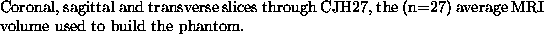 \begin{figure}\begin{center}
\centerline{
\epsfxsize=5in \epsfbox{./figure1.eps...
...average MRI volume used to build the phantom.}
}
\small
\end{center}\end{figure}