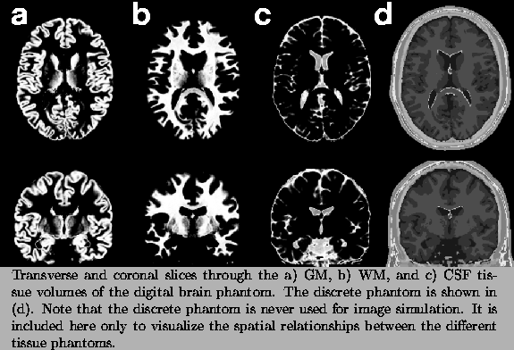 \begin{figure}\begin{center}
\centerline{
\epsfxsize=5in \epsfbox{figure3.eps} ...
...nships between the different tissue phantoms.}
}
\small
\end{center}\end{figure}