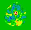 fMRI Activation 
Map