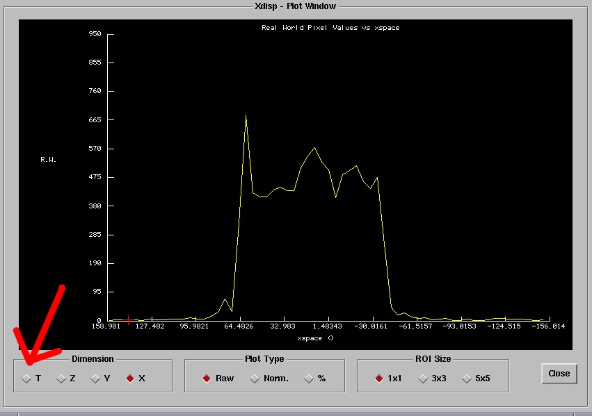 xdisp Default Plot Screen