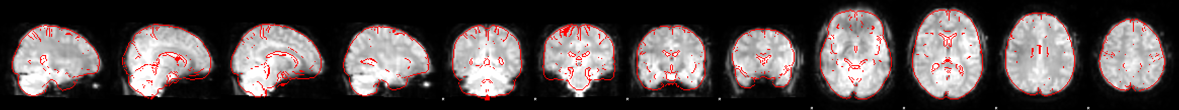 fmrib flirt Functional data were aligned to structural images (within-subject) initially using linear registration (fmrib's linear image registration tool, flirt. fmrib flirt Functional data were aligned to structural images (within-subject) initially using linear registration (fmrib's linear image registration tool, flirt.