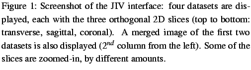 $\textstyle \parbox{0.9\linewidth}{
\figurenum
Screenshot of the JIV interfac...
...lumn from the left). Some of the slices
are zoomed-in, by different amounts.
}$