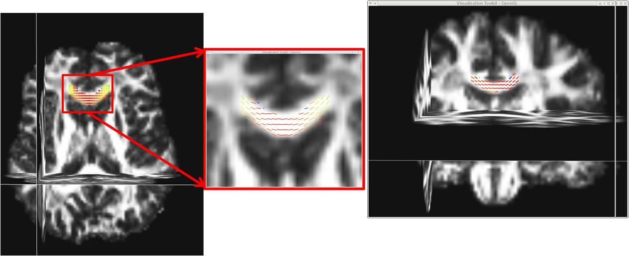 DTI vector image