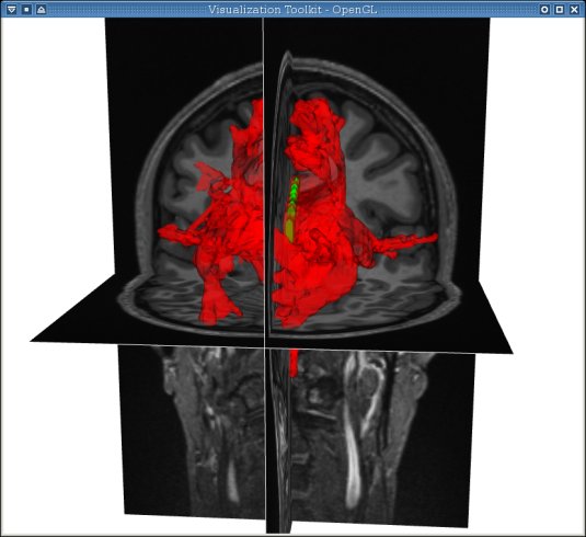 ROI image
