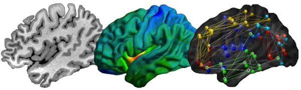 2019 International Training Course on Neuroimaging of Epilepsy